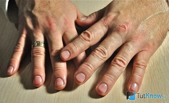 Мужские ногти после маникюра