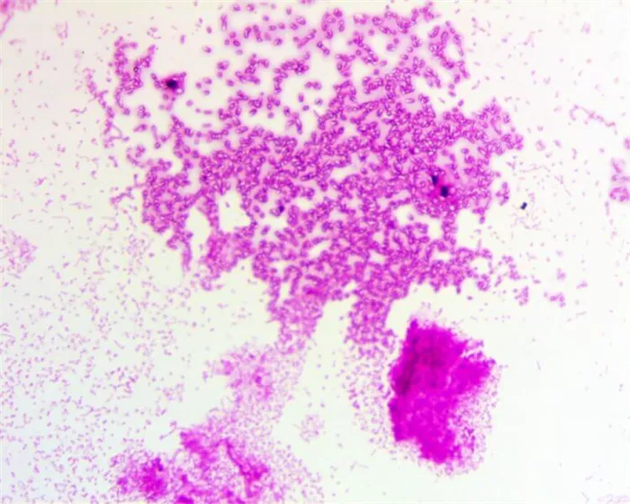 Бактерия, которая не позволяет дышать — Clostridium botulinum. Так выглядит Clostridium botulinum. Фото.